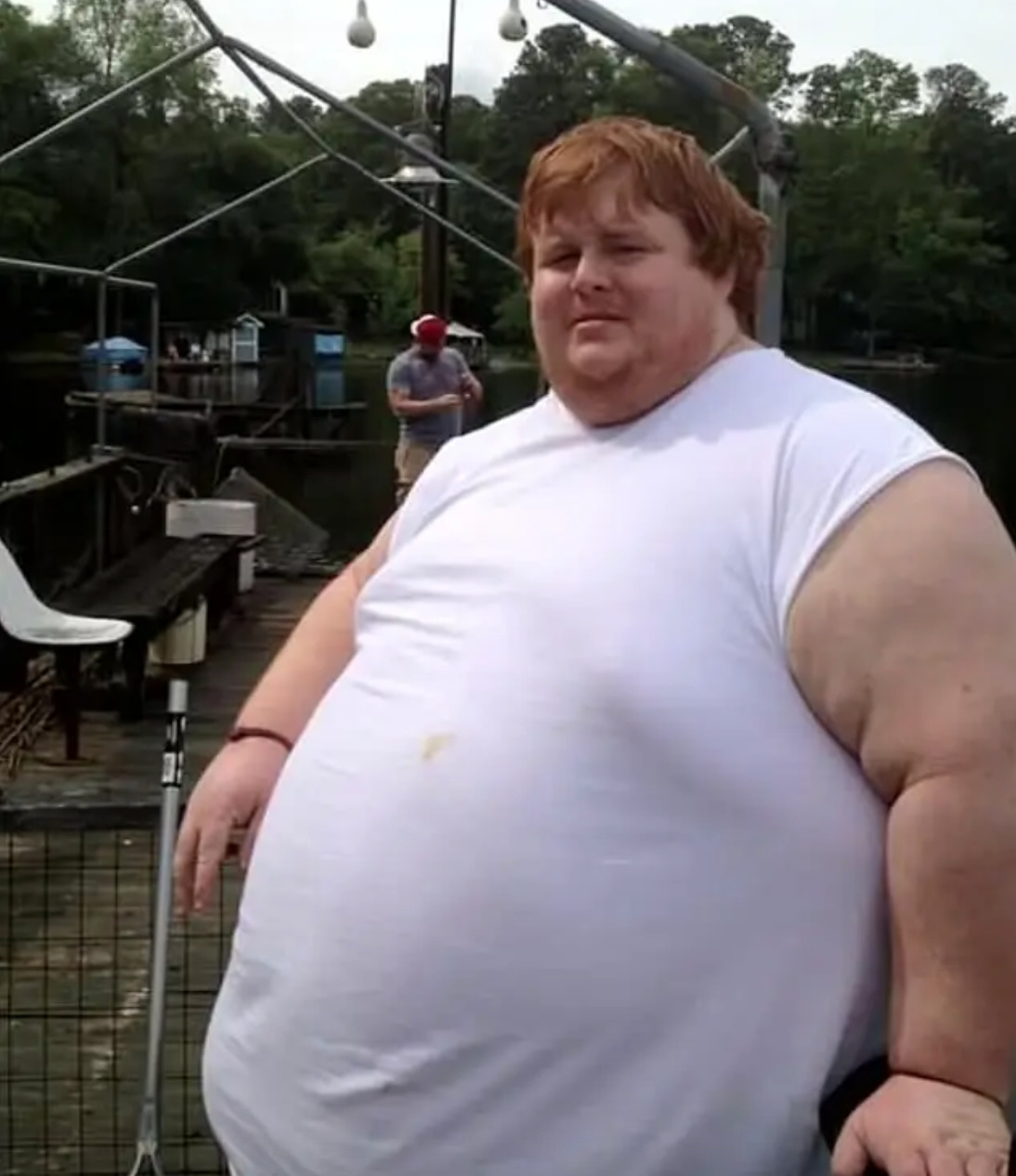 Кейси Кинг: парень весом 320 кг